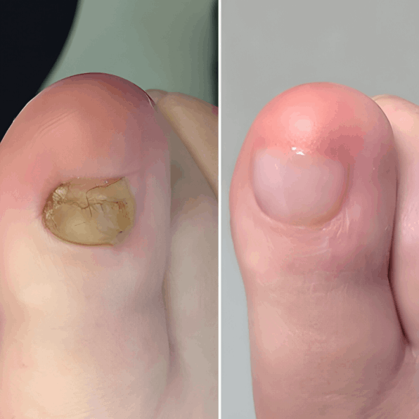 Hewelth BioClear user Dylan P.